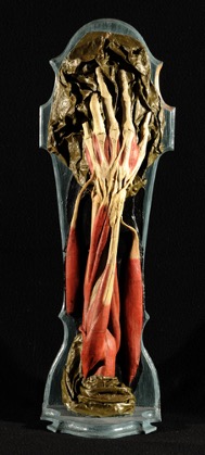 An anatomical model of an arm and hand, from the elbow to the fingers. It is standing upright with the fingers pointing up, in a class case. It is a model of the bones, muscles, and ligaments, with no skin or nails. 
