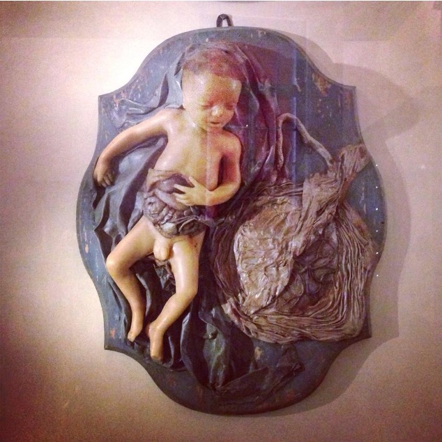 A wax model figure of a newborn infant alongside the amniotic sac, just after birth. The infant’s abdomen is cut open to expose the organs inside and the connection of the umbilical cord to the sac. 